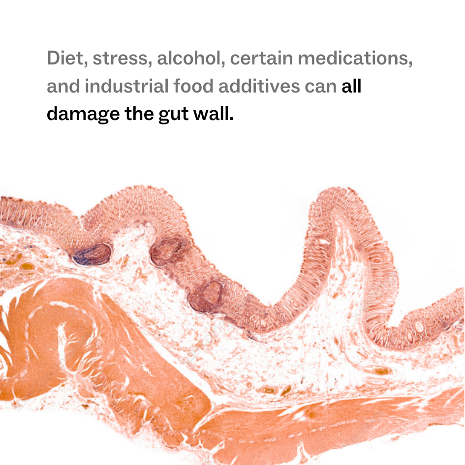 Complete Gut Repair System