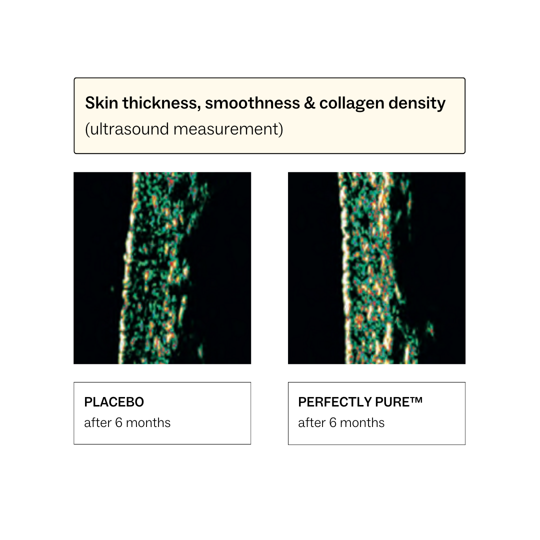 Perfectly Pure Collagen™