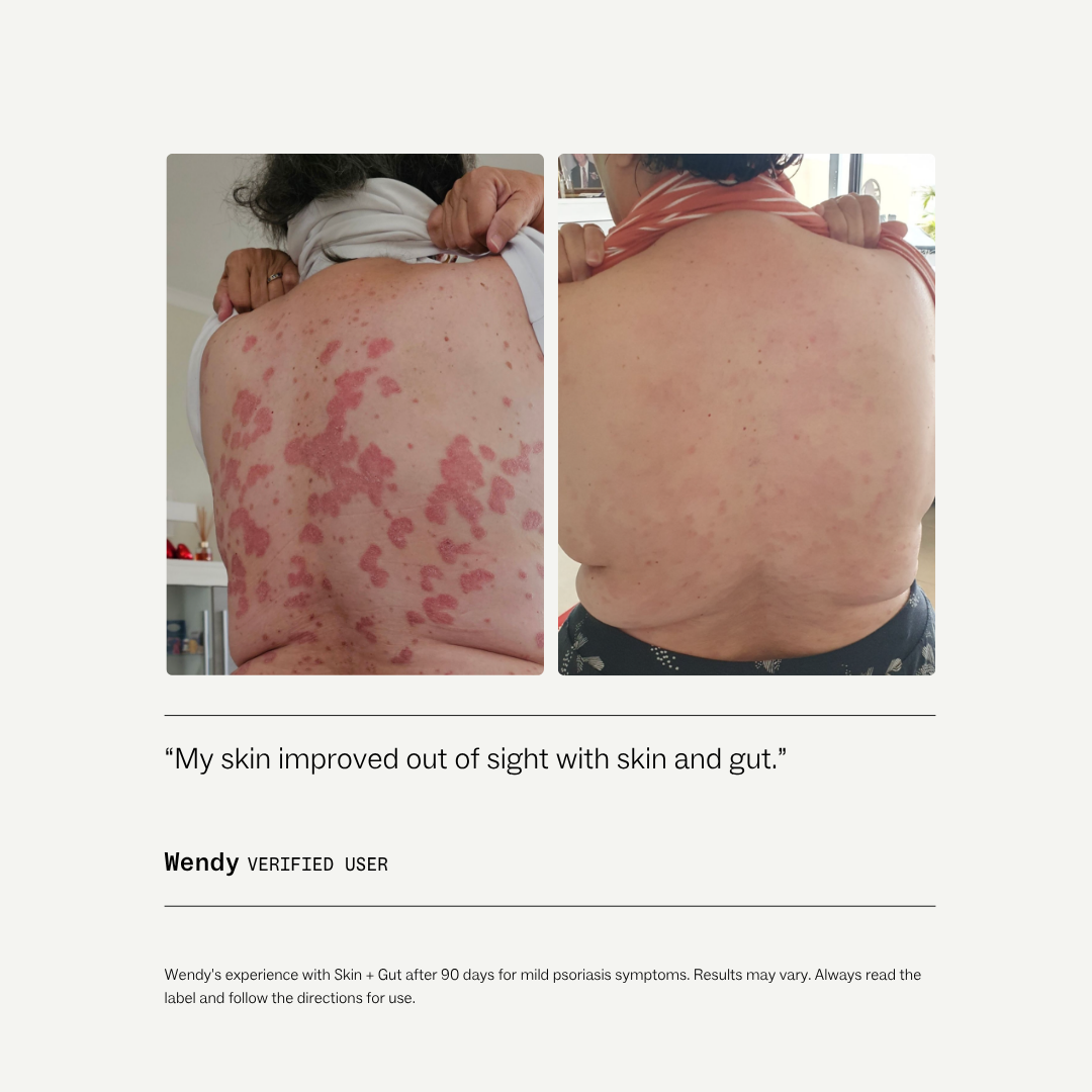 Skin + Gut™