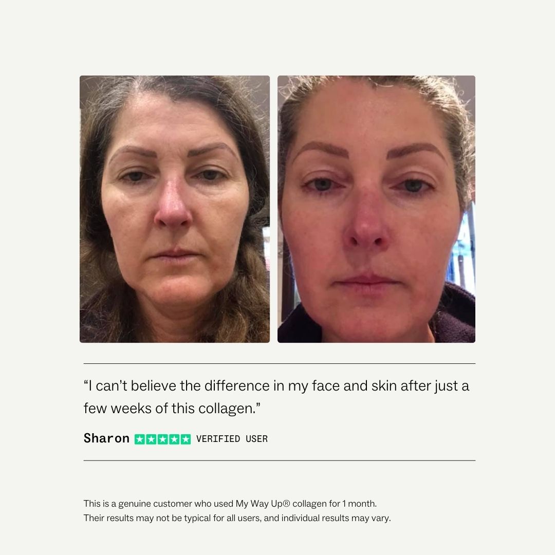 Collagen Restore™