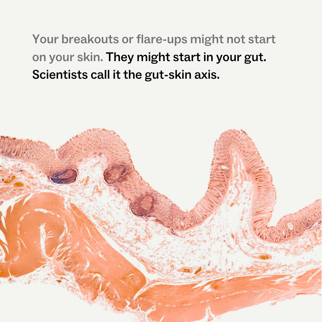 Skin + Gut™