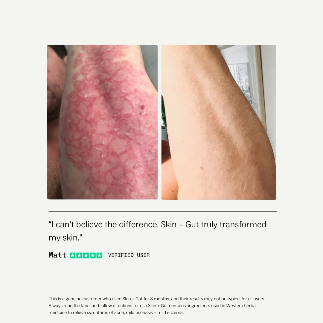 Advanced Skin Health System